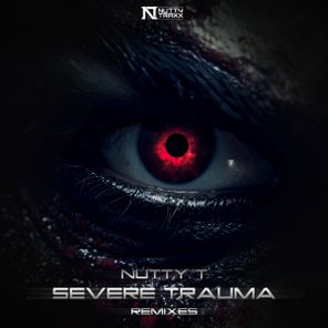 The Fallen, Nutty T – Severe Trauma (Remixes)
