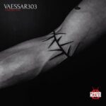 Vaessar303 – Chronic Pain