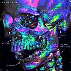 Flaps – X-Sequence